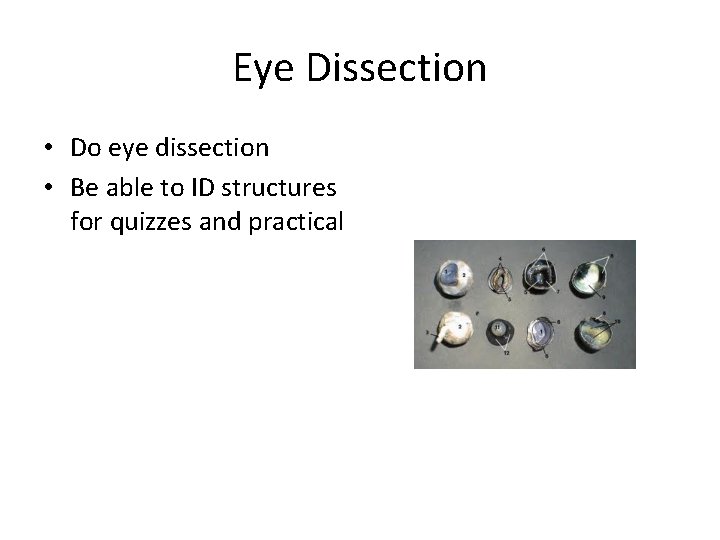 Eye Dissection • Do eye dissection • Be able to ID structures for quizzes