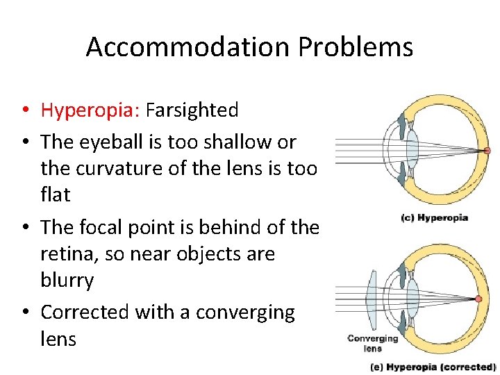Accommodation Problems • Hyperopia: Farsighted • The eyeball is too shallow or the curvature