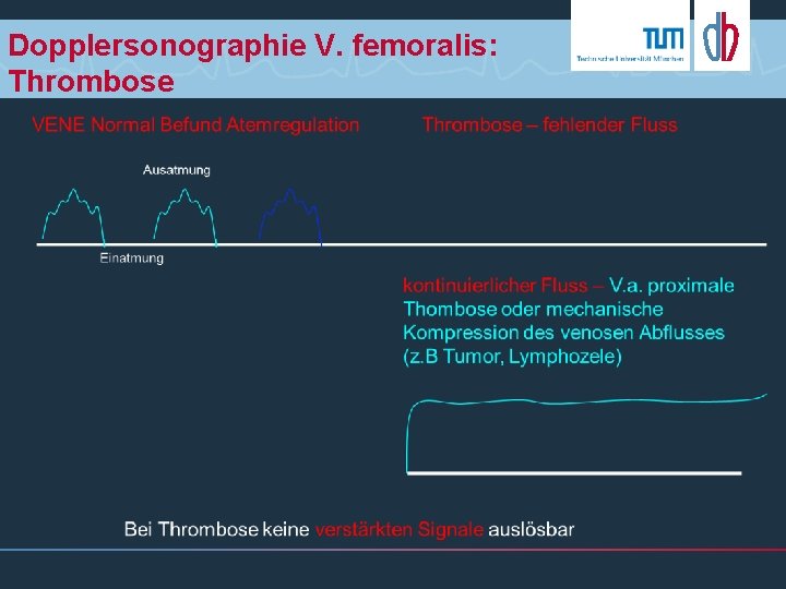 Dopplersonographie V. femoralis: Thrombose 