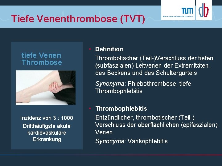 Tiefe Venenthrombose (TVT) tiefe Venen Thrombose • Definition Thrombotischer (Teil-)Verschluss der tiefen (subfaszialen) Leitvenen