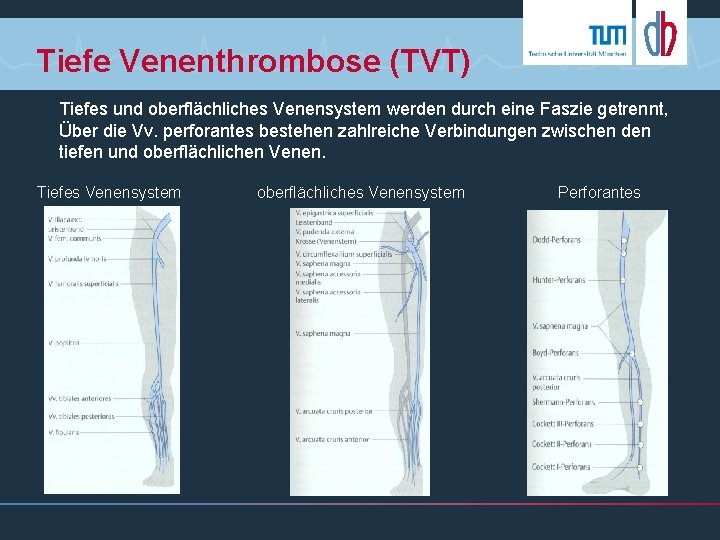 Tiefe Venenthrombose (TVT) Tiefes und oberflächliches Venensystem werden durch eine Faszie getrennt, Über die