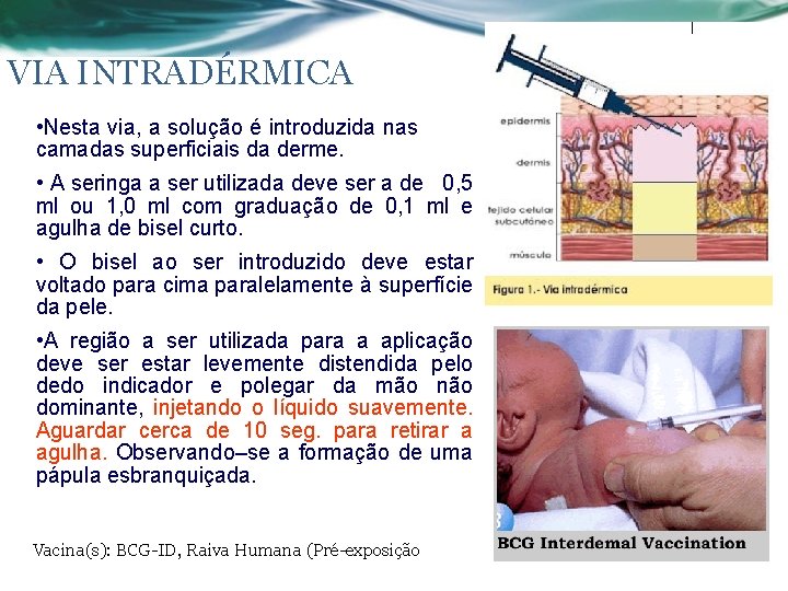VIA INTRADÉRMICA • Nesta via, a solução é introduzida nas camadas superficiais da derme.