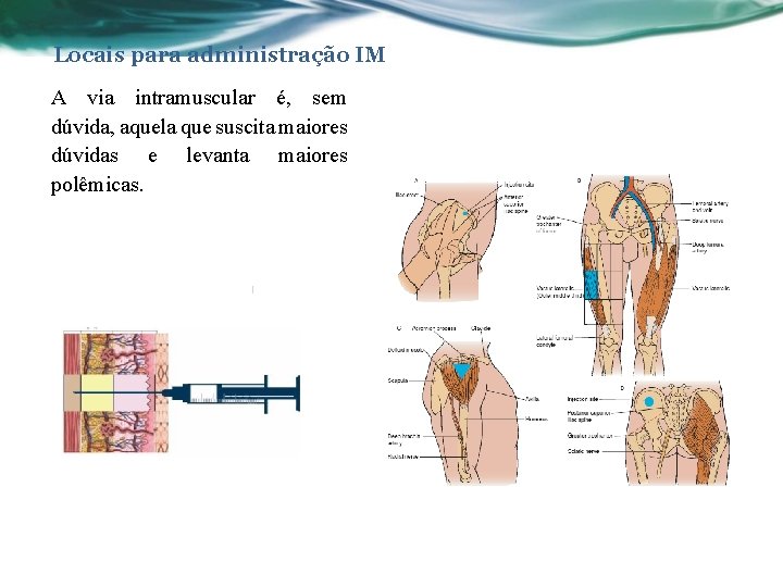 Locais para administração IM A via intramuscular é, sem dúvida, aquela que suscita maiores