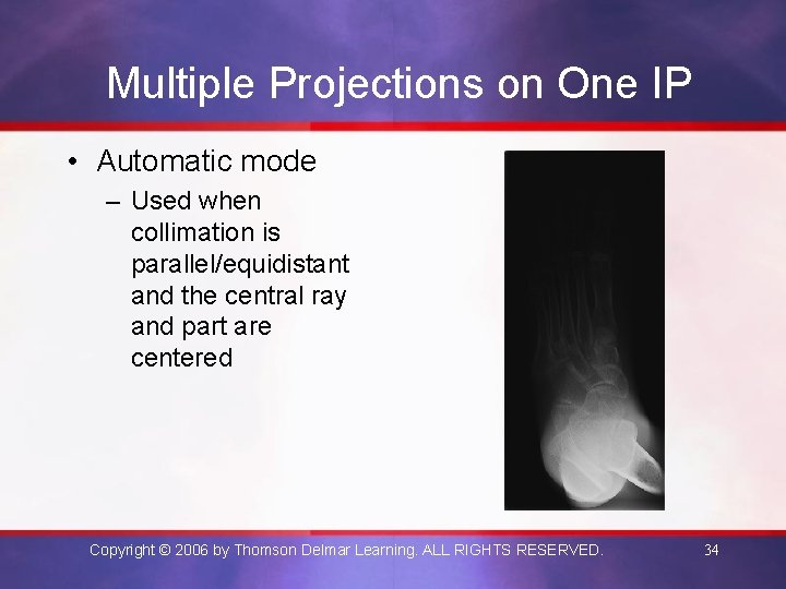 Multiple Projections on One IP • Automatic mode – Used when collimation is parallel/equidistant