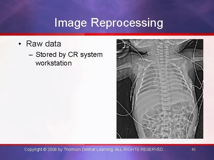 Image Reprocessing • Raw data – Stored by CR system workstation Copyright © 2006