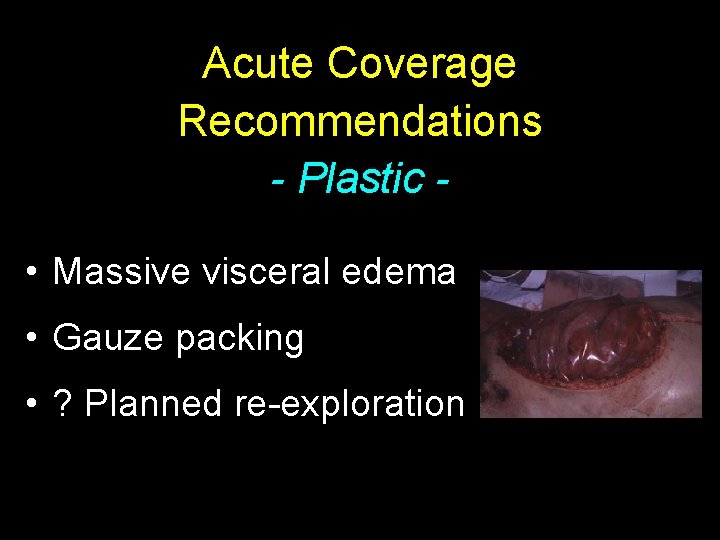 Acute Coverage Recommendations - Plastic • Massive visceral edema • Gauze packing • ?