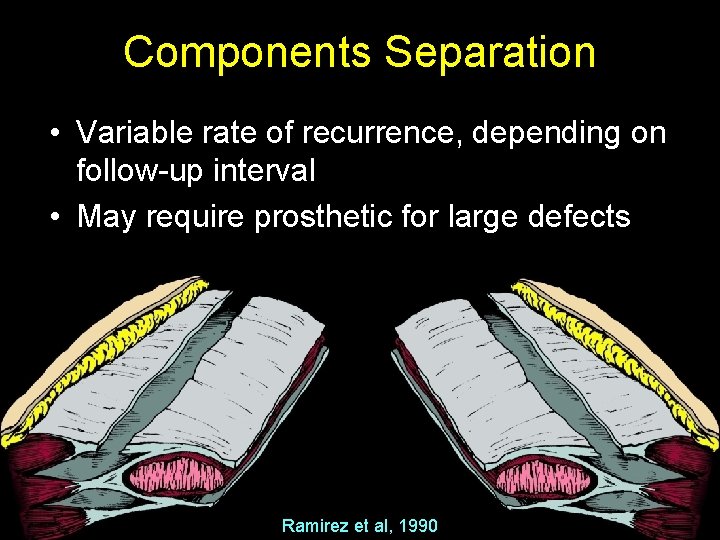 Components Separation • Variable rate of recurrence, depending on follow-up interval • May require