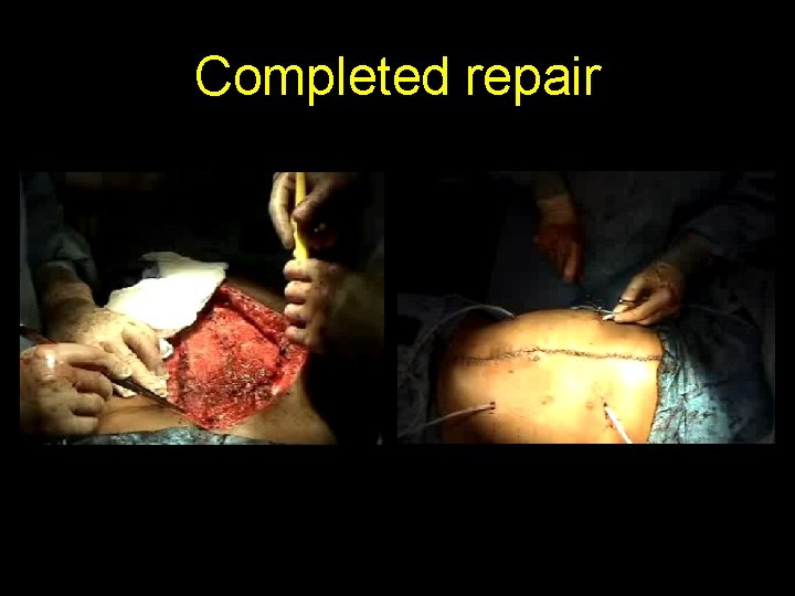 Completed repair 