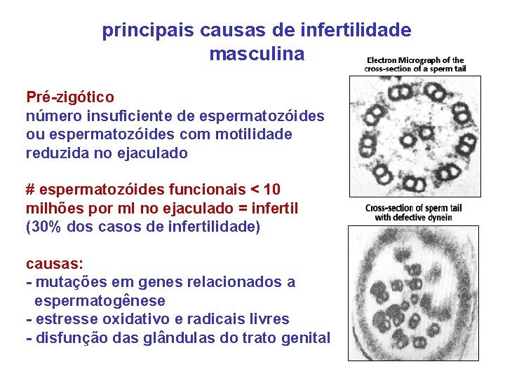 principais causas de infertilidade masculina Pré-zigótico número insuficiente de espermatozóides ou espermatozóides com motilidade