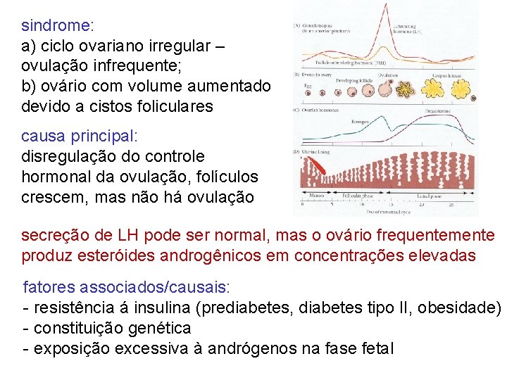 sindrome: a) ciclo ovariano irregular – ovulação infrequente; b) ovário com volume aumentado devido