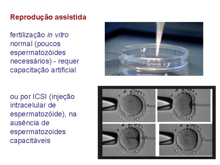 Reprodução assistida fertilização in vitro normal (poucos espermatozóides necessários) - requer capacitação artificial ou