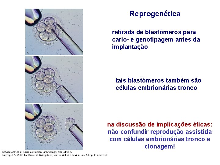 Reprogenética retirada de blastómeros para cario- e genotipagem antes da implantação tais blastómeros também