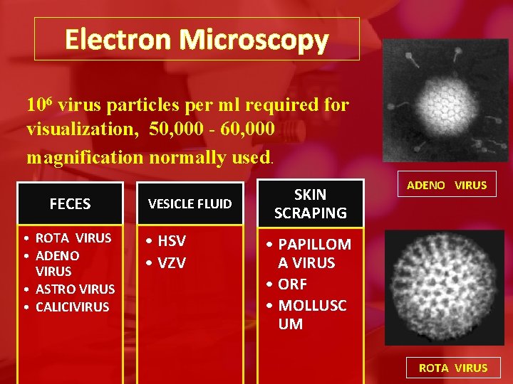 Electron Microscopy 106 virus particles per ml required for visualization, 50, 000 - 60,