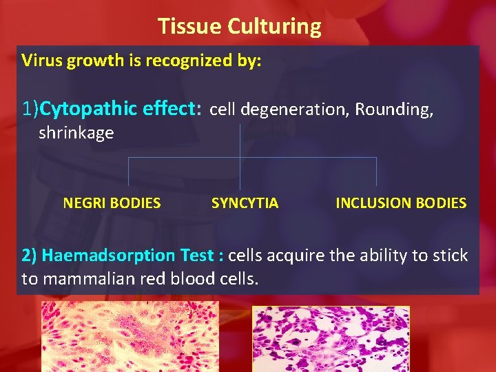 Tissue Culturing Virus growth is recognized by: 1)Cytopathic effect: cell degeneration, Rounding, shrinkage NEGRI