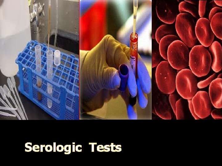 Serologic Tests 