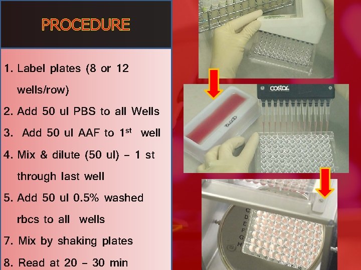 PROCEDURE 1. Label plates (8 or 12 wells/row) 2. Add 50 ul PBS to