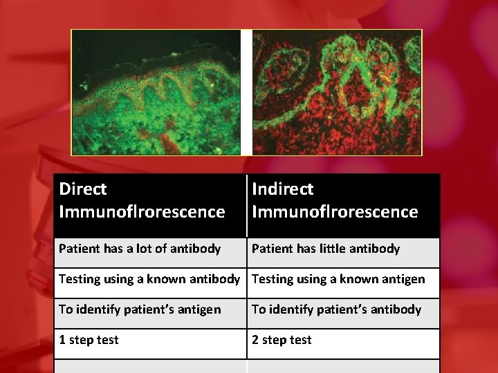 Direct Immunoflrorescence Indirect Immunoflrorescence Patient has a lot of antibody Patient has little antibody