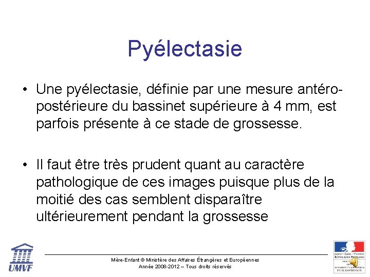 Pyélectasie • Une pyélectasie, définie par une mesure antéropostérieure du bassinet supérieure à 4