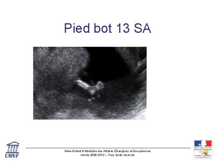 Pied bot 13 SA Mère-Enfant © Ministère des Affaires Étrangères et Européennes Année 2008