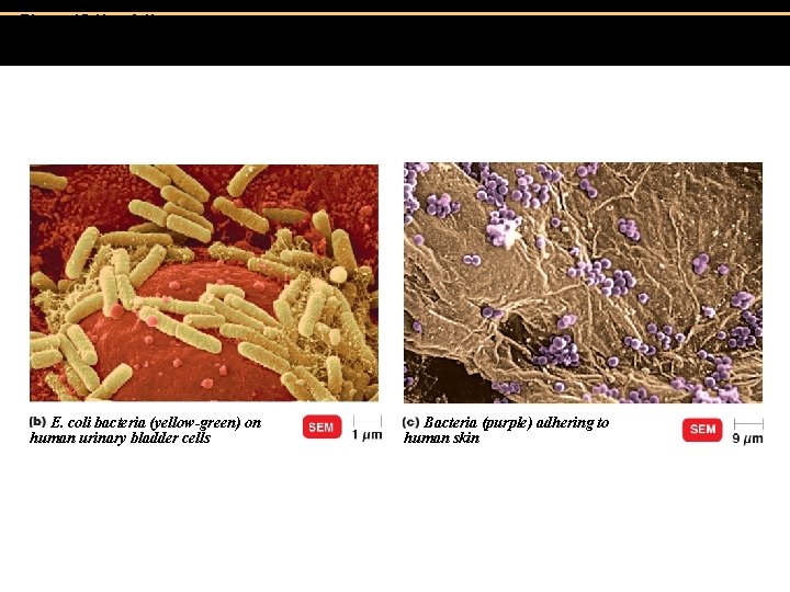 Figure 15. 1 b-c Adherence. E. coli bacteria (yellow-green) on human urinary bladder cells Figure 15. 1 b-c Adherence. E. coli bacteria (yellow-green) on human urinary bladder cells
