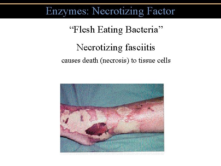 Enzymes: Necrotizing Factor “Flesh Eating Bacteria” Necrotizing fasciitis causes death (necrosis) to tissue cells