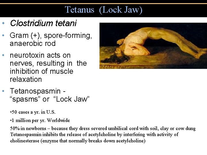 Tetanus (Lock Jaw) • Clostridium tetani • Gram (+), spore-forming, anaerobic rod • neurotoxin