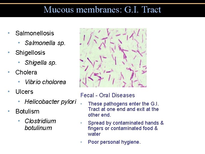 Mucous membranes: G. I. Tract • Salmonellosis • Salmonella sp. • Shigellosis • Shigella Mucous membranes: G. I. Tract • Salmonellosis • Salmonella sp. • Shigellosis • Shigella