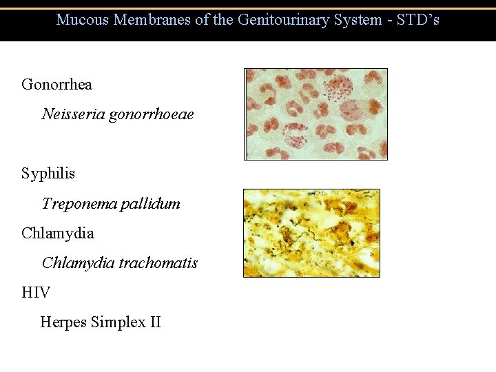 Mucous Membranes of the Genitourinary System - STD’s Gonorrhea Neisseria gonorrhoeae Syphilis Treponema pallidum Mucous Membranes of the Genitourinary System - STD’s Gonorrhea Neisseria gonorrhoeae Syphilis Treponema pallidum