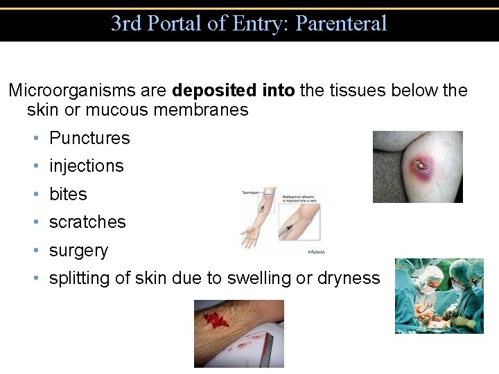 3 rd Portal of Entry: Parenteral Microorganisms are deposited into the tissues below the