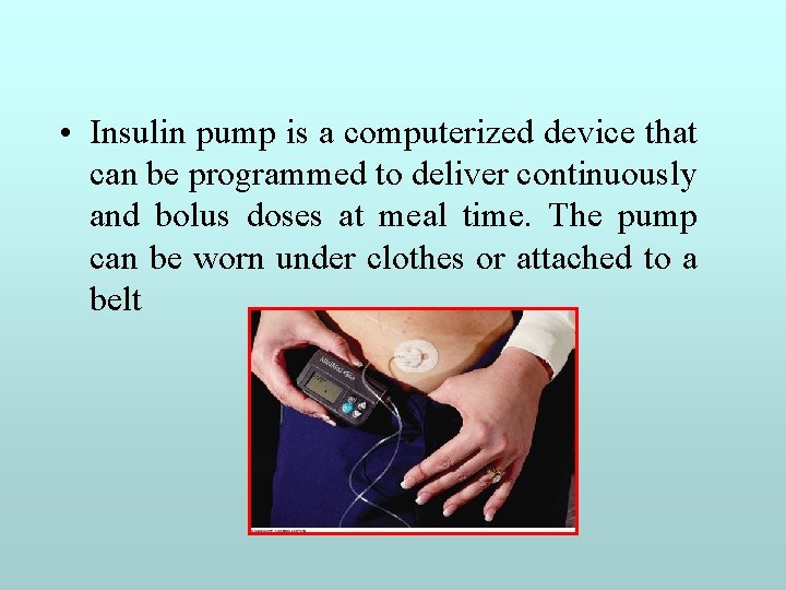  • Insulin pump is a computerized device that can be programmed to deliver