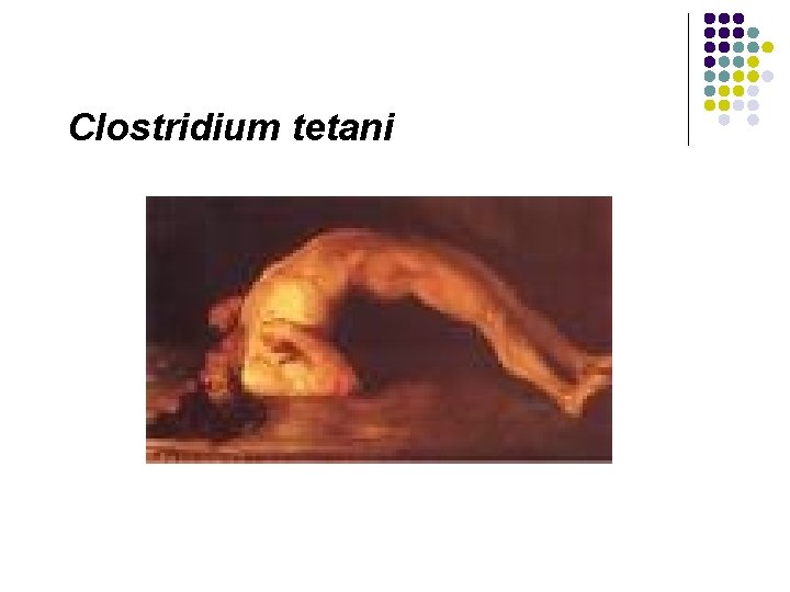 Clostridium tetani 