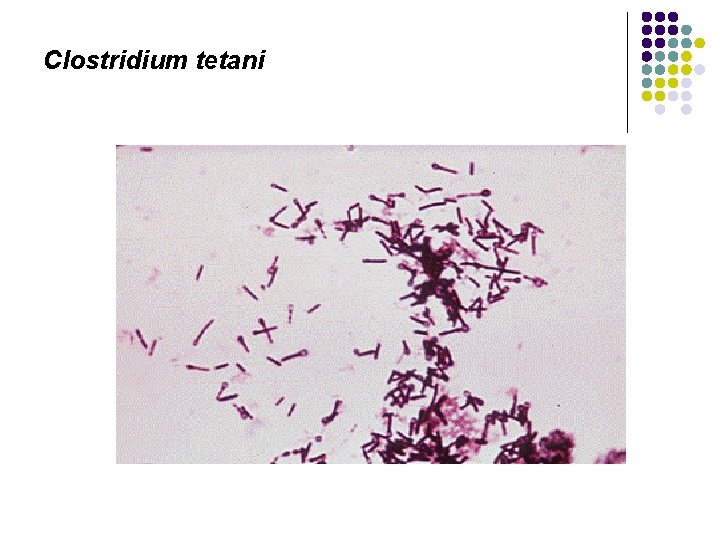 Clostridium tetani 