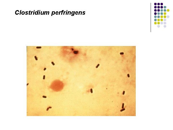 Clostridium perfringens 