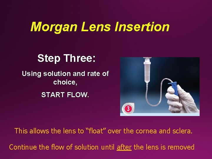 Morgan Lens Insertion Step Three: Using solution and rate of choice, START FLOW. This