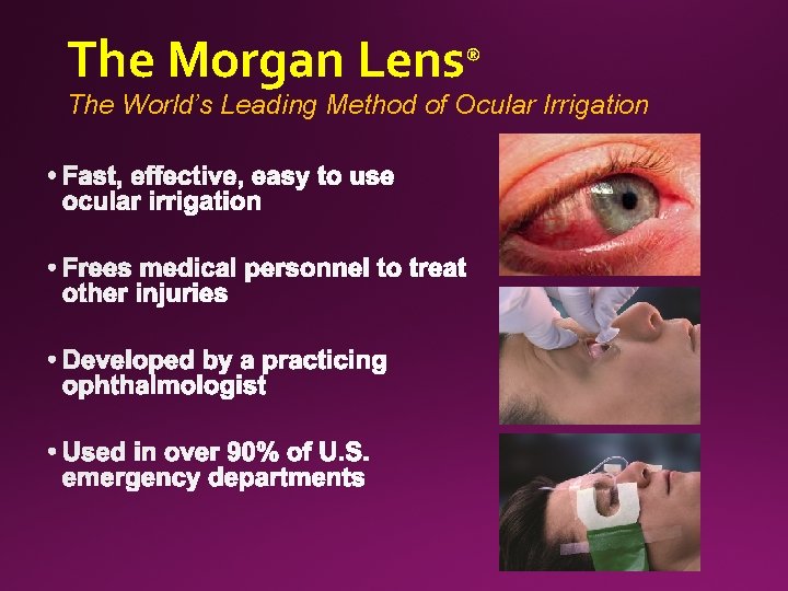 The Morgan Lens® The World’s Leading Method of Ocular Irrigation 