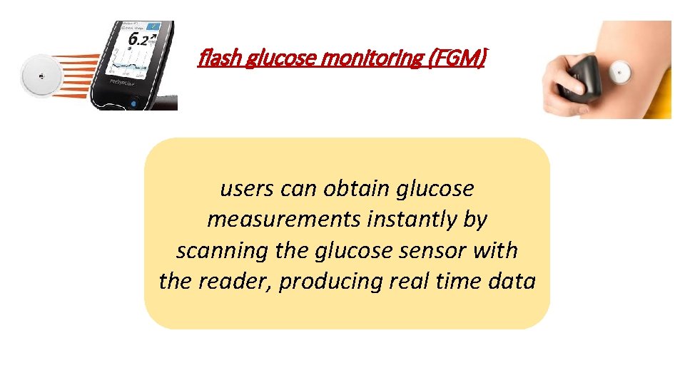 flash glucose monitoring (FGM) users can obtain glucose measurements instantly by scanning the glucose