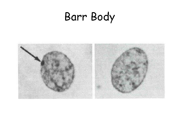 Barr Body 