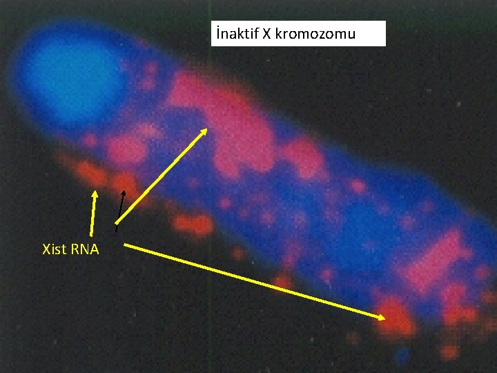 İnaktif X kromozomu Xist RNA 