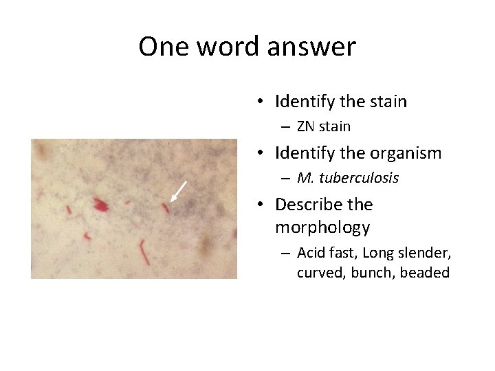 One word answer • Identify the stain – ZN stain • Identify the organism