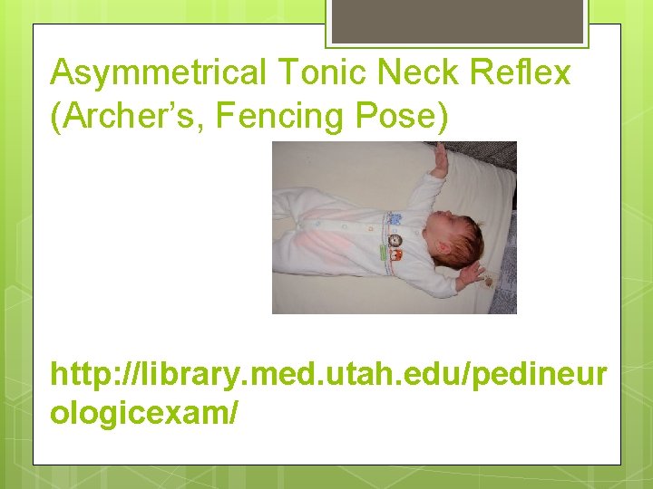 Asymmetrical Tonic Neck Reflex (Archer’s, Fencing Pose) http: //library. med. utah. edu/pedineur ologicexam/ 