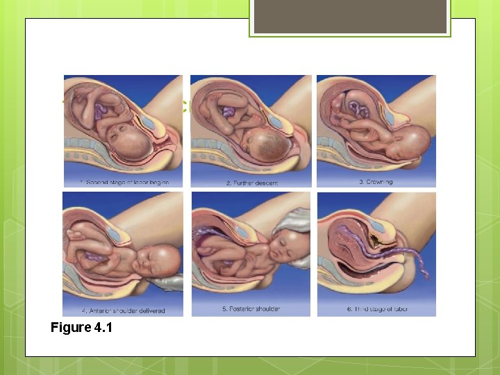 The Stages of Childbirth Figure 4. 1 