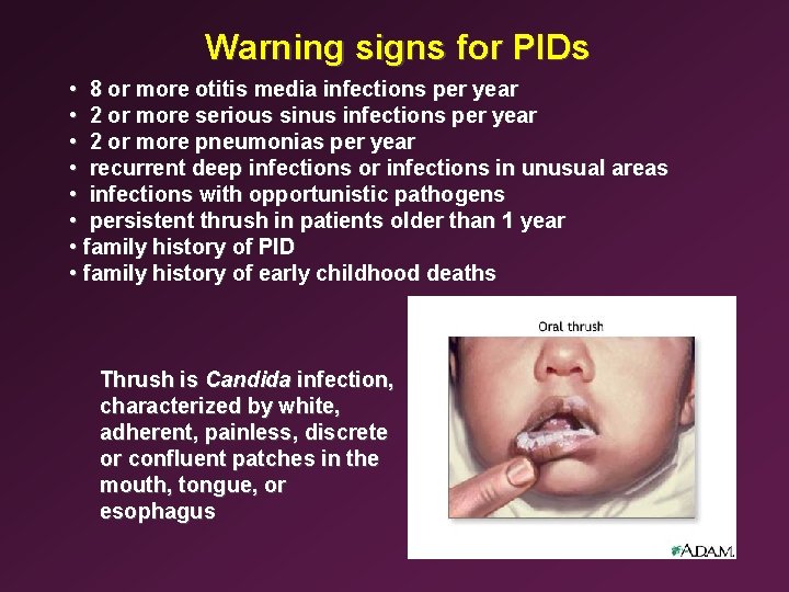 Warning signs for PIDs • 8 or more otitis media infections per year •