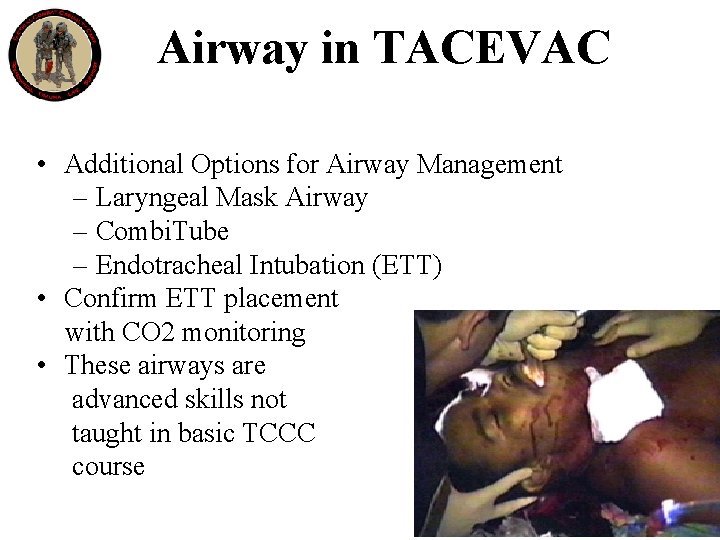 Airway in TACEVAC • Additional Options for Airway Management – Laryngeal Mask Airway –