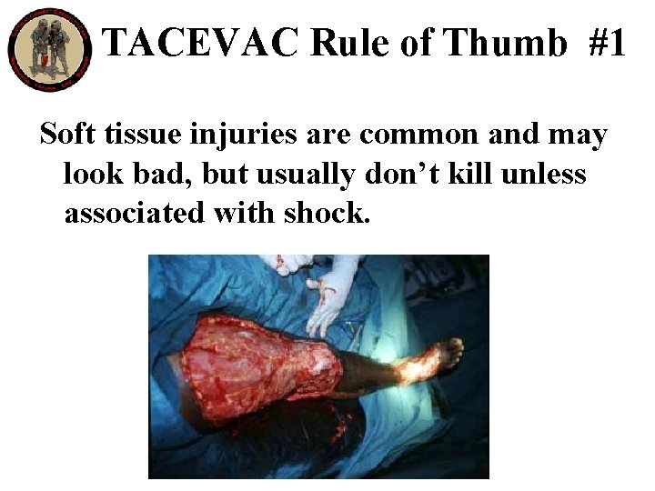 TACEVAC Rule of Thumb #1 Soft tissue injuries are common and may look bad,