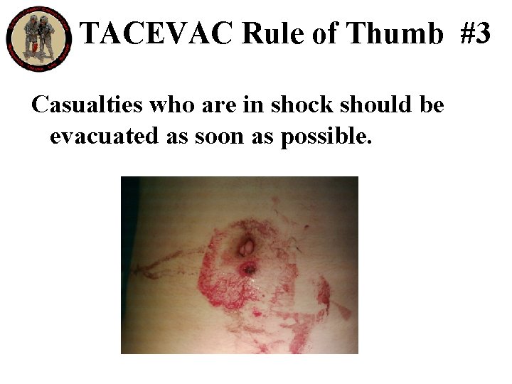 TACEVAC Rule of Thumb #3 Casualties who are in shock should be evacuated as