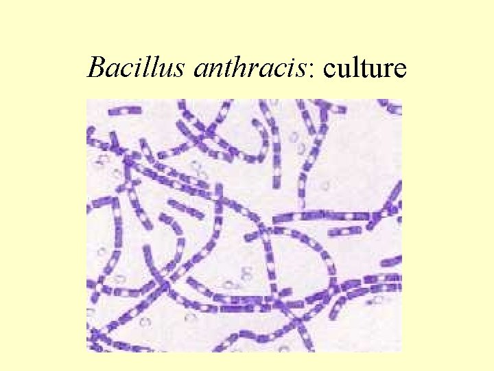 Bacillus anthracis: culture 