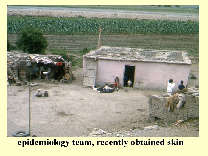 An anthrax site near the road. Notice the epidemiology team, recently obtained skin 