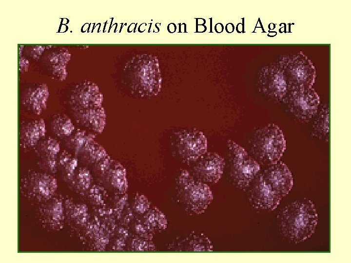 B. anthracis on Blood Agar 