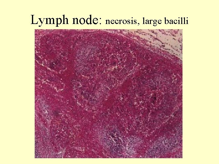 Lymph node: necrosis, large bacilli 