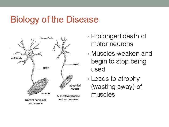 Biology of the Disease • Prolonged death of motor neurons • Muscles weaken and